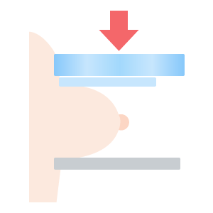 マンモグラフィー2方向